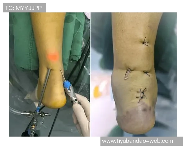 张佳玮点评爱德华兹技术提升背打急停变向对抗能力显著增强 张佳玮点评爱德华兹技术提升背打急停变向对抗能力显著增强